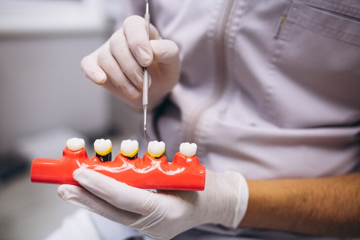 Enhance Your Smile: Discover The Magic Of Dental Veneers In Tucson