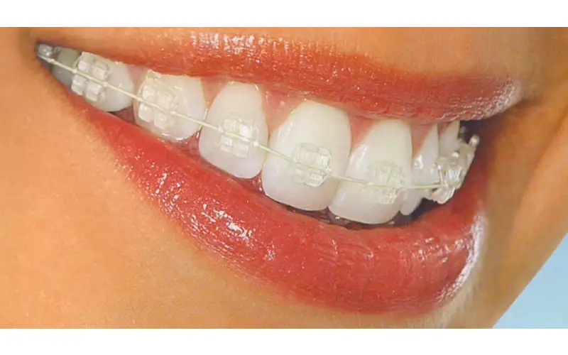 emergency dentist Cookeville TN